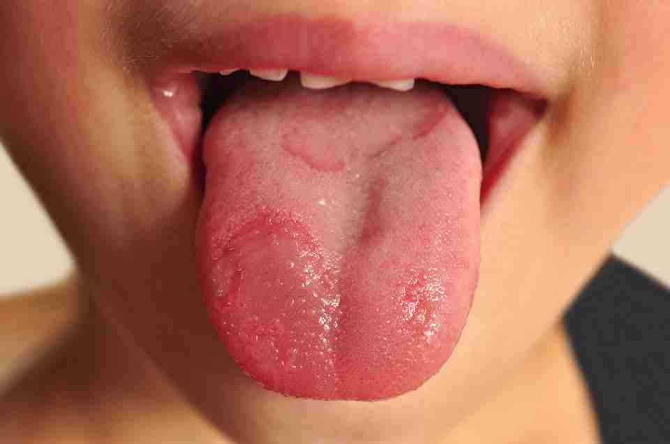 Other Health Problems