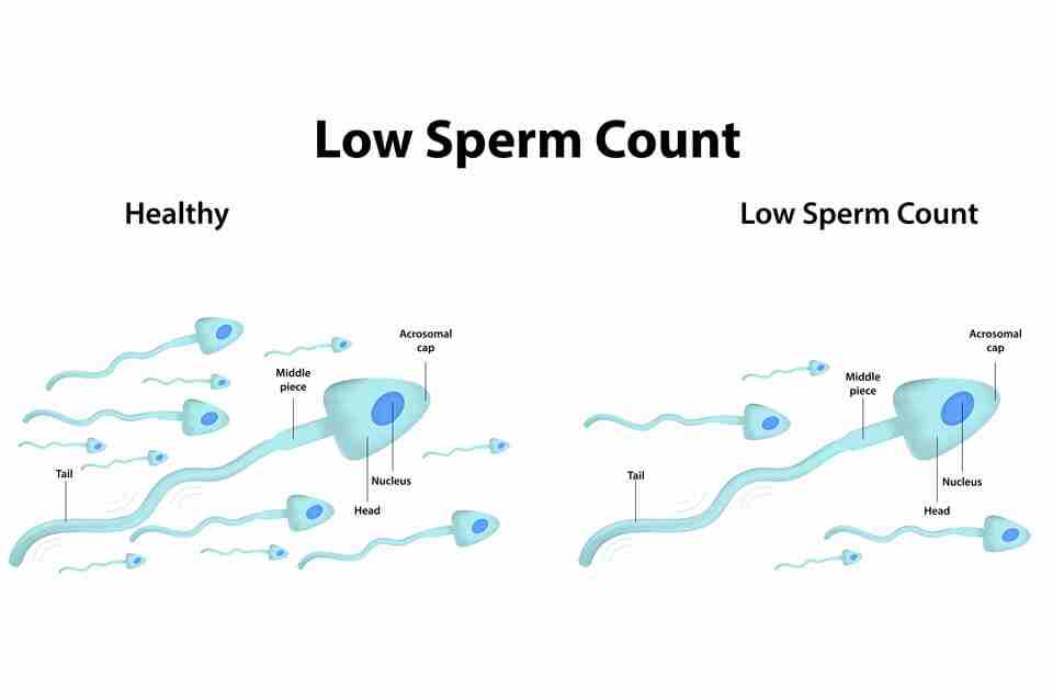Sexual Health