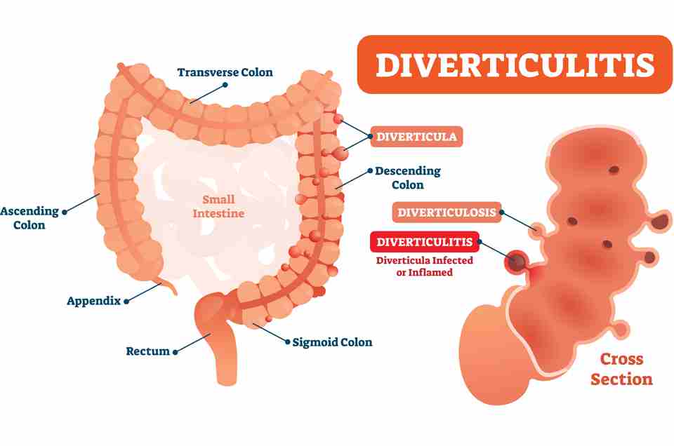 Digestive Health