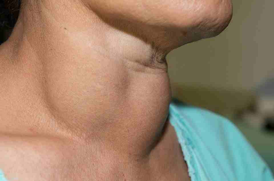 Endocrine Disorders